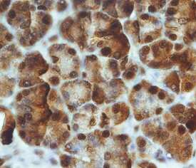 PTF1A was detected in immersion fixed paraffin-embedded sections of human pancreas using Goat Anti-Human PTF1A Antigen Affinity-purified Polyclonal Antibody (Catalog # AF6119) at 15 µg/mL overnight at 4 °C. Tissue was stained using the Anti-Goat HRP-DAB Cell & Tissue Staining Kit (brown; Catalog # CTS008) and counterstained with hematoxylin (blue). Specific staining was localized to nuclei. View our protocol for Chromogenic IHC Staining of Paraffin-embedded Tissue Sections.