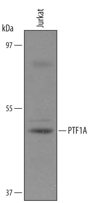 Western blot shows lysates of Jurkat human acute T cell leukemia cell line. PVDF Membrane was probed with 1 µg/mL of Goat Anti-Human PTF1A Antigen Affinity-purified Polyclonal Antibody (Catalog # AF6119) followed by HRP-conjugated Anti-Goat IgG Secondary Antibody (Catalog # HAF019). A specific band was detected for PTF1A at approximately 45 kDa (as indicated). This experiment was conducted under reducing conditions and using Immunoblot Buffer Group 8.