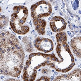     Prostaglandin  E Synthase 2/PTGES2 was detected in immersion fixed paraffin-embedded  sections of human kidney using Sheep Anti-Human Prostaglandin E Synthase  2/PTGES2 Antigen Affinity-purified Polyclonal Antibody (Catalog # AF7627) at  0.3 µg/mL for 1 hour at room temperature followed by  incubation with the Anti-Sheep IgG VisUCyte™ HRP Polymer Antibody  (Catalog # VC006).  Tissue was stained using DAB (brown) and counterstained with hematoxylin  (blue). Specific staining was localized to cytoplasm in convoluted tubules.  View our protocol for IHC  Staining with VisUCyte HRP Polymer Detection Reagents. 