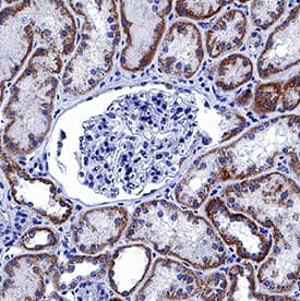     Prostaglandin  E Synthase 2/PTGES2 was detected in immersion fixed paraffin-embedded  sections of human kidney using Mouse Anti-Human Prostaglandin E Synthase  2/PTGES2 Monoclonal Antibody (Catalog # MAB7627) at  5 µg/mL for 1 hour at room temperature followed by  incubation with the Anti-Mouse IgG VisUCyte™ HRP Polymer Antibody  (Catalog # VC001).  Before incubation with the primary antibody, tissue was subjected to  heat-induced epitope retrieval using Antigen Retrieval Reagent-Basic (Catalog  # CTS013).  Tissue was stained using DAB (brown) and counterstained with hematoxylin  (blue). Specific staining was localized to cytoplasm in epithelial cells in  convoluted tubules. View our protocol for IHC  Staining with VisUCyte HRP Polymer Detection Reagents. 