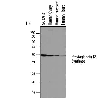 Western blot shows lysates of SK-OV-3 human ovarian adenocarcinoma cell line, human ovary tissue, human prostate tissue, and human heart tissue. PVDF membrane was probed with 1 µg/mL of Sheep Anti-Human Prostaglandin I2 Synthase Antigen Affinity-purified Polyclonal Antibody (Catalog # AF7788) followed by HRP-conjugated Anti-Sheep IgG Secondary Antibody (Catalog # HAF016). A specific band was detected for Prostaglandin I2 Synthase at approximately 50 kDa (as indicated). This experiment was conducted under reducing conditions and using Immunoblot Buffer Group 1.