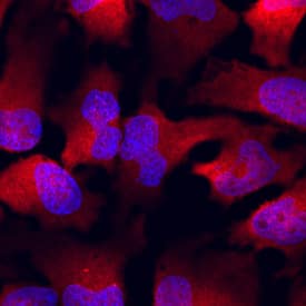 PUM1 was detected in immersion fixed HeLa human cervical epithelial carcinoma cell line using Sheep Anti-Human/Mouse PUM1 Antigen Affinity-purified Polyclonal Antibody (Catalog # AF7628) at 10 µg/mL for 3 hours at room temperature. Cells were stained using the NorthernLights™ 557-conjugated Anti-Sheep IgG Secondary Antibody (red; Catalog # NL010) and counterstained with DAPI (blue). Specific staining was localized to cytoplasm. View our protocol for Fluorescent ICC Staining of Cells on Coverslips.