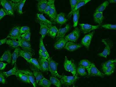 PUM2 Antibody (NBP2-97161): Novus Biologicals