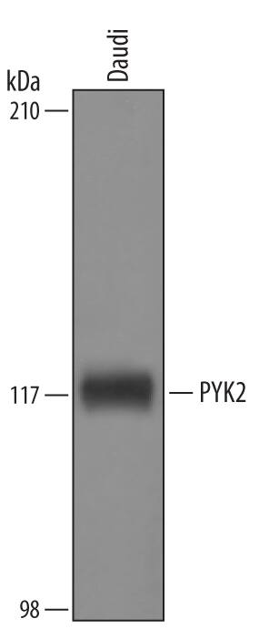 Western blot shows lysates of Daudi human Burkitt's lymphoma cell line. PVDF membrane was probed with 1 µg/mL of Sheep Anti-Human PYK2/FAK2 Biotinylated Antigen Affinity-purified Polyclonal Antibody (Catalog # BAF4589) followed by HRP-conjugated Anti-Sheep IgG Secondary Antibody (Catalog # HAF016). A specific band was detected for PYK2/FAK2 at approximately 116 kDa (as indicated). This experiment was conducted under reducing conditions and using Immunoblot Buffer Group 1.