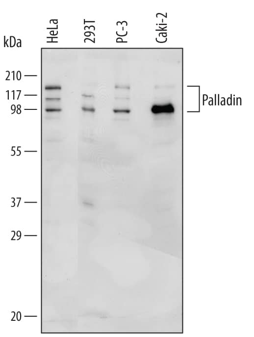 Western Blot Palladin Antibody [Unconjugated]