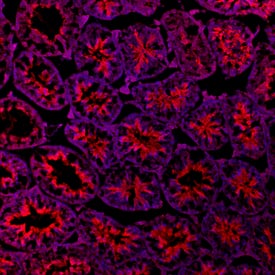 Immunohistochemistry Patched 2/PTCH2 Antibody (865619)