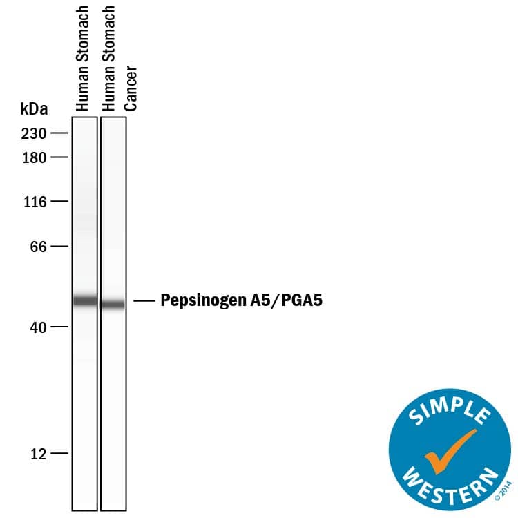     Simple  Western lane view shows lysates of human stomach tissue and human stomach  cancer tissue, loaded at 0.2 mg/mL. A specific band was detected for  Pepsinogen A5/PGA5 at approximately 48 kDa (as indicated)  using 20 µg/mL of Sheep Anti-Human Pepsinogen A5/PGA5  Antigen Affinity-purified Polyclonal Antibody (Catalog # AF8457) followed by  1:50 dilution of HRP-conjugated Anti-Sheep IgG Secondary Antibody  (Catalog # HAF016).  This experiment was conducted under reducing conditions and using the 12‑230 kDa separation system. 