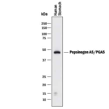 Western Blot PGA5 Antibody [Unconjugated]