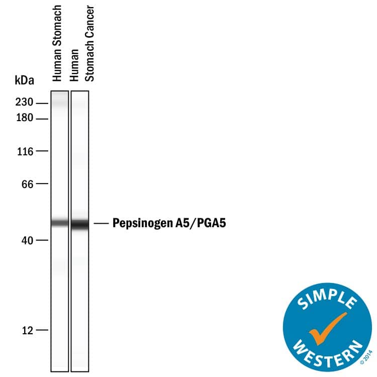     Simple  Western lane view shows lysates of human stomach tissue and human stomach  cancer tissue, loaded at 0.2 mg/mL. A specific band was detected for  Pepsinogen A5/PGA5 at approximately 48 kDa (as indicated)  using 20 µg/mL of Mouse Anti-Human Pepsinogen A5/PGA5  Monoclonal Antibody (Catalog # MAB8457) . This experiment was conducted under  reducing conditions and using the 12-230 kDa separation system.   Non-specific  interaction with the 230 kDa Simple Western standard may be seen with this  antibody.  