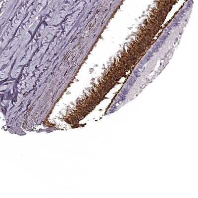 Immunohistochemistry-Paraffin: Phosducin Antibody [NBP2-56992] - Staining of human retina shows strong cytoplasmic and nuclear positivity in photoreceptor layer.