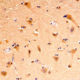 Immunohistochemistry Piccolo Antibody
