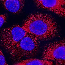 Pleiotrophin/PTN was detected in immersion fixed PC-3 human prostate cancer cell line using Recombinant Rat Anti-Human Pleiotrophin/PTN Monoclonal Antibody (Catalog # MAB252R) at 10 µg/mL for 3 hours at room temperature. Cells were stained using the NorthernLights™ 557-conjugated Anti-Rat IgG Secondary Antibody (red; Catalog # NL013) and counterstained with DAPI (blue). Specific staining was localized to cytoplasm. View our protocol for Fluorescent ICC Staining of Cells on Coverslips.