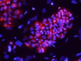 Podocalyxin was detected in immersion fixed BG01V human embryonic stem cells using 10 µg/mL Mouse Anti-Human Podocalyxin Monoclonal Antibody (Catalog # MAB1658) for 3 hours at room temperature. Cells were stained with the NorthernLights™ 557-conjugated Anti-Mouse IgG Secondary Antibody (red; Catalog # NL007) and counterstained with DAPI (blue). View our protocol for Fluorescent ICC Staining of Cells on Coverslips.