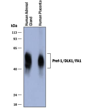 Western blot shows lysates of human adrenal gland tissue and human placenta tissue. PVDF membrane was probed with 1 µg/mL of Goat Anti-Human Pref‑1/DLK1/FA1 Antigen Affinity-purified Polyclonal Antibody (Catalog # AF1144) followed by HRP-conjugated Anti-Goat IgG Secondary Antibody (Catalog # HAF017). A specific band was detected for Pref‑1/DLK1/FA1 at approximately 45-60 kDa (as indicated). This experiment was conducted under reducing conditions and using Immunoblot Buffer Group 1.