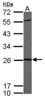 Proteasome 20S alpha 6 Antibody (NBP1-32406): Novus Biologicals