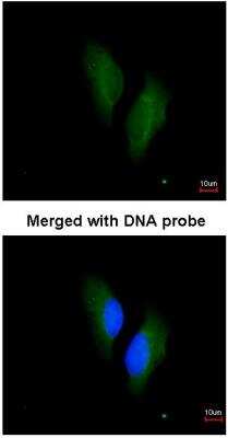 Protein S/PROS1 Antibody (NBP1-31375): Novus Biologicals