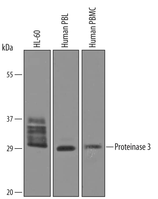 Western blot shows lysates of HL-60 human acute promyelocytic leukemia cell line, human peripheral blood lymphocytes (PBL), and human peripheral blood mononuclear cells (PBMC). PVDF Membrane was probed with 1 µg/mL of Sheep Anti-Human Proteinase 3/Myeloblastin/PRTN3 Antigen Affinity-purified Polyclonal Antibody (Catalog # AF6134) followed by HRP-conjugated Anti-Sheep IgG Secondary Antibody (HAF016). A specific band was detected for Proteinase 3/Myeloblastin/ PRTN3 at approximately 32 kDa (as indicated). This experiment was conducted under reducing conditions and using Immunoblot Buffer Group 8.