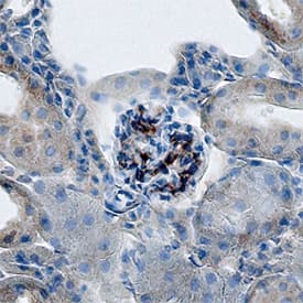 Immunohistochemistry Protocadherin-12 Antibody (868909)