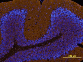 Protocadherin  alpha 1 was detected in perfusion fixed frozen sections of mouse brain using Sheep Anti-Human Protocadherin  alpha 1 Antigen Affinity-purified Polyclonal Antibody (Catalog # AF5064) at 10 µg/mL overnight at 4 °C. Tissue was stained using the NorthernLights™ 557-conjugated Anti-Sheep IgG Secondary Antibody (yellow; Catalog # NL010) and counter­stained with DAPI (blue). View our protocol for Fluorescent IHC Staining of Frozen Tissue Sections.