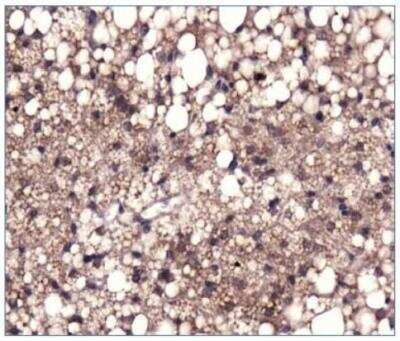 Immunohistochemistry-Paraffin: Pyruvate Carboxylase Antibody [NBP1-49536] - IHC analysis of a formalin fixed and paraffin embedded tissue section of mouse adipose tissue using rabbit anti-Pyruvate Carboxylase antibody at 1:200 dilution. The signal was developed using HRP conjugated anti-rabbit secondary antibody and DAB reagent. The nuclei were counterstained using hematoxylin. This Pyruvate Carboxylase antibody generated a specific staining of the fat cells in the tested section. 