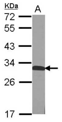 QDPR Antibody (NBP2-15084): Novus Biologicals