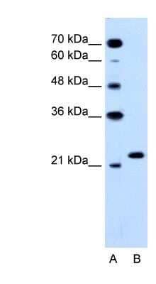Western Blot: RAB14 Antibody [NBP1-79962] - Titration: 0.2-1 ug/ml, Positive Control: HepG2 cell lysate.