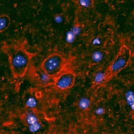 RAGE was detected in perfusion fixed frozen sections of mouse spinal cord using Rat Anti-Mouse RAGE Monoclonal Antibody (Catalog # MAB11794) at 25 µg/mL overnight at 4 °C. Tissue was stained using the NorthernLights™ 557-conjugated Anti-Rat IgG Secondary Antibody (red; Catalog # NL013) and counterstained with DAPI (blue). Specific staining was localized to the plasma membranes of motor neurons. View our protocol for Fluorescent IHC Staining of Frozen Tissue Sections.