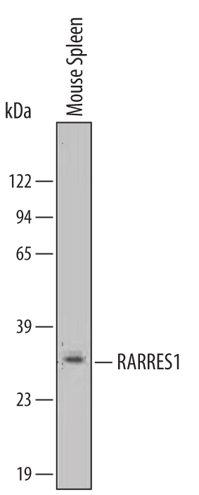 Western Blot RARRES1 Antibody [Unconjugated]