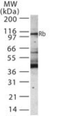 Western Blot: RB1 Antibody [NB100-56888] - Analysis of Retinoblastoma 1 in 30 ugs of Jurkat cell lysate using NB100-56888 at 1:1000 dilution.