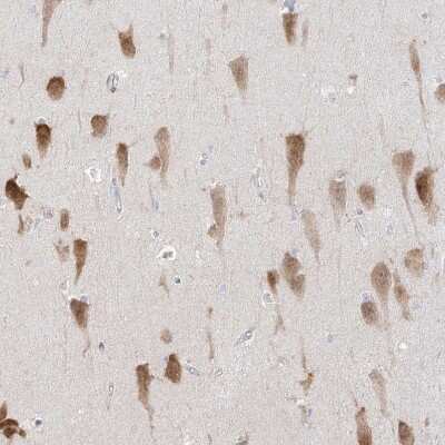 Immunohistochemistry-Paraffin: RBFOX3/NeuN Antibody [NBP1-89821] - Staining of human hippocampus shows strong nuclear and cytoplasmic positivity in pyramidal cells.