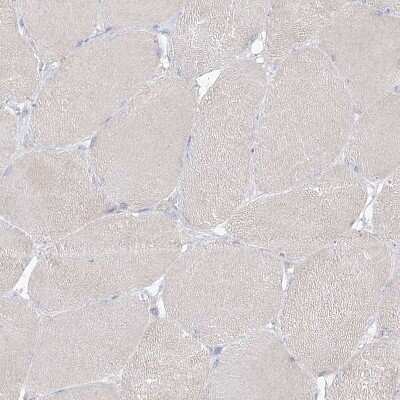 Immunohistochemistry-Paraffin: RBFOX3/NeuN Antibody [NBP1-89821] - Staining of human skeletal muscle shows no positivity in myocytes as expected.