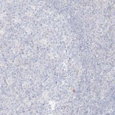 Immunohistochemistry-Paraffin: RBFOX3/NeuN Antibody [NBP1-89821] - Staining of human tonsil shows no positivity in germinal center cells as expected.