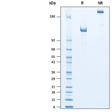 2 μg/lane of Recombinant Human RECK Fc Chimera (Catalog # 10309-RE) was  resolved with SDS-PAGE under reducing (R) and non-reducing (NR)  conditions and visualized by Coomassie® Blue staining, showing a band under reducing conditions at ~131 kDa.