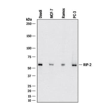     Western  blot shows lysates of Daudi human Burkitt's lymphoma cell line,  MCF‑7 human breast cancer cell line, Ramos human Burkitt's  lymphoma cell line, and PC‑3 human prostate cancer cell line. PVDF  membrane was probed with 2 µg/mL of Mouse Anti-Human RIPK2/RIP2  Monoclonal Antibody (Catalog # MAB103871) followed by HRP-conjugated  Anti-Mouse IgG Secondary Antibody (Catalog # HAF018).  A specific band was detected for RIPK2/RIP2 at approximately 62 kDa  (as indicated). This experiment was conducted under reducing conditions and  using Immunoblot  Buffer Group 1. 