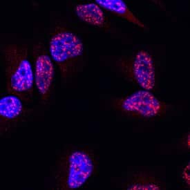 Immunocytochemistry RNF168 Antibody [Unconjugated]