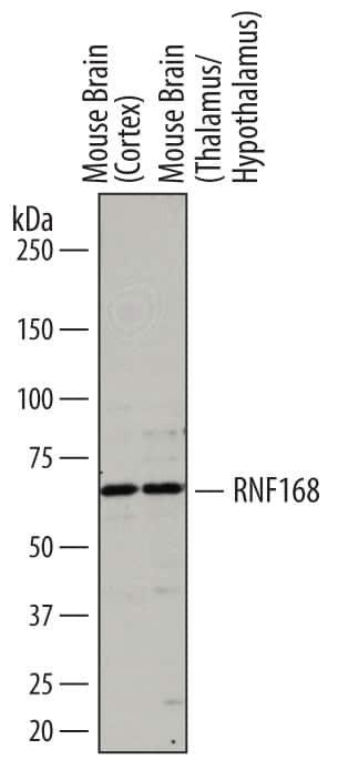 Western Blot RNF168 Antibody [Unconjugated]