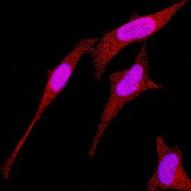 RNF4 was detected in immersion fixed HeLa human cervical epithelial carcinoma cell line using Goat Anti-Human RNF4 Antigen Affinity-purified Polyclonal Antibody (Catalog # AF7964) at 1.7 µg/mL for 3 hours at room temperature. Cells were stained using the NorthernLights&amp;#8482; 557-conjugated Anti-Goat IgG Secondary Antibody (red; Catalog # &lt;a class=