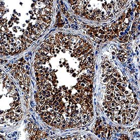 RNF4 was detected in immersion fixed paraffin-embedded sections of human testis using Goat Anti-Human RNF4 Antigen Affinity-purified Polyclonal Antibody (Catalog # AF7964) at 10 µg/mL overnight at 4 °C. Tissue was stained using the Anti-Goat HRP-DAB Cell & Tissue Staining Kit (brown; Catalog # CTS008) and counterstained with hematoxylin (blue). Specific staining was localized to nuclei and cytoplasm. View our protocol for Chromogenic IHC Staining of Paraffin-embedded Tissue Sections.