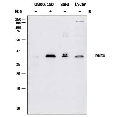 Western blot shows lysates of GM00719D human ataxia telangiectasia cell line either mock-treated (-) or exposed (+) to 10 Gy ionizing radiation (IR) and harvested after 1 hour, BaF3 mouse pro-B cell line, and LNCaP human prostate cancer cell line. PVDF membrane was probed with 1 µg/mL of Goat Anti-Human RNF4 Antigen Affinity-purified Polyclonal Antibody (Catalog # AF7964) followed by HRP-conjugated Anti-Goat IgG Secondary Antibody (Catalog # &lt;a class=