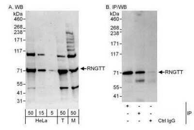 Western Blot: RNGTT Antibody [NBP1-49973] - Detection of Human and Mouse RNGTT by Western Blot (h&amp;m) and Immunoprecipitation (h).  Samples: Whole cell lysate from HeLa (5, 15 and 50 mcg for WB; 1 mg for IP, 20% of IP loaded), 293T (T; 50 mcg), and mouse NIH3T3 (M; 50 mcg) cells.  Antibodies: Affinity purified rabbit anti-RNGTT antibody used for WB at 0.04 mcg/ml (A) and 0.4 mcg/ml (B) and used for IP at 3 mcg/mg lysate.  RNGTT was also immunoprecipitated by rabbit anti-RNGTT antibody which recognizes an upstream epitope.  For blotting immunoprecipitated RNGTT was used.  Detection: Chemiluminescence with exposure times of 3 minutes (A) and 30 seconds (B).