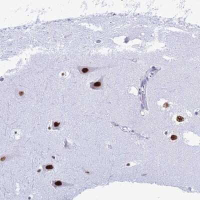 Immunohistochemistry-Paraffin: RNPS1 Antibody [NBP1-92343] - Staining of human hippocampus shows strong nuclear positivity in neuronal cells.