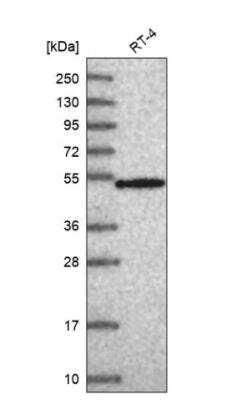Western Blot: RNPS1 Antibody [NBP1-92343] - Analysis in human cell line RT-4.