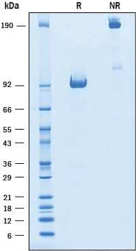 2 μg/lane of Recombinant Mouse ROR1 was resolved with SDS-PAGEunder reducing (R) and non-reducing (NR) conditions and visualized by Coomassie® Blue staining, showing bands at88-100 kDa and 180-200 kDa,respectively.