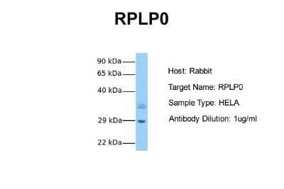 Western Blot: RPLP0 Antibody [NBP1-57528] - Sample Tissue: Human Hela Antibody Dilution: 1.0 ug/ml