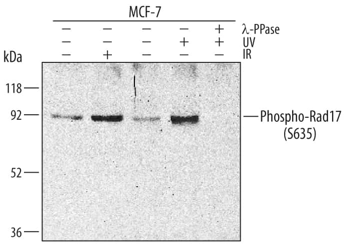 Western blot shows lysates of MCF-7 human breast cancer cell line mock treated or exposed to 10 Gy IR or 100 J/m2UV-C for 1 hour. PVDF membrane was probed with 0.5 µg/mL Rabbit Anti-Human Phospho-Rad17 (S635) Antigen Affinity-purified Polyclonal Antibody (Catalog # AF1374) followed by HRP-conjugated Anti-Rabbit IgG Secondary Antibody (Catalog # HAF008). A specific band for Phospho-Rad17 (S635) was detected at approximately 92 kDa (as indicated). The phospho-specificity of this antibody was supported by decreased labeling following treatment with 600 U lambda-phosphatase (lambda-PPase) for 30 minutes time. This experiment was conducted under reducing conditions and using Immunoblot Buffer Group 1.