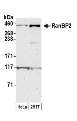 Western Blot: RanBP2 Antibody [NB100-93337] - Detection of Human RanBP2 by Western Blot. Samples: Whole cell lysate (50 ug) from HeLa and 293T cells prepared using NETN lysis buffer. Antibody: Affinity purified rabbit anti-RanBP2 antibody NB100-93337 used for WB at 0.1 ug/ml. Detection: Chemiluminescence with an exposure time of 3 minutes.