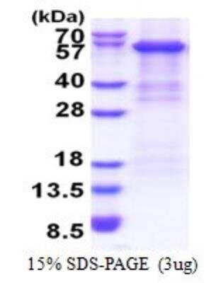 Complement Factor B Proteins: Novus Biologicals