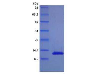 Human IL13 variant Recombinant Protein: Novus Biologicals