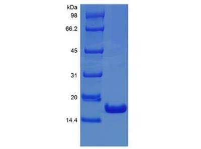 Human Interferon alpha 2b Recombinant Protein: Novus Biologicals