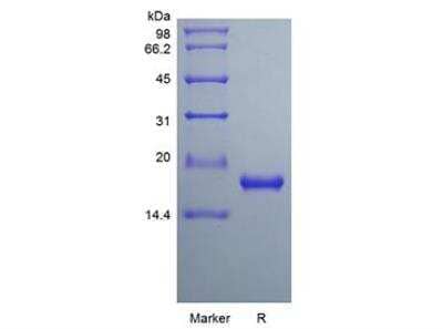 Rat IL33 Recombinant Protein: Novus Biologicals